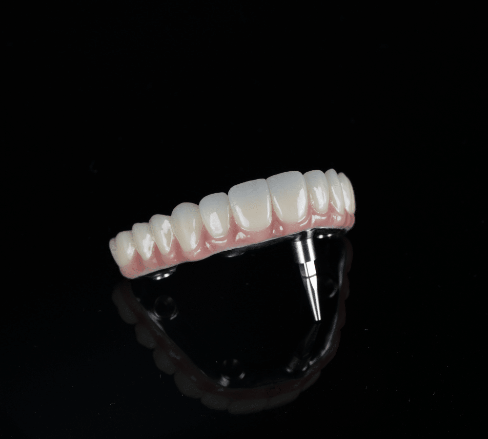 All In One Solution Dental Implants Melbourne | Teeth Implants | Smile Solutions